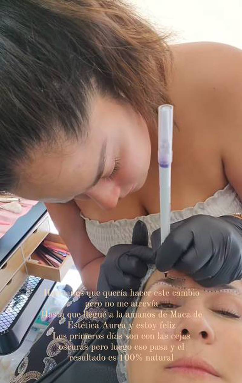 Michelle Adam estrena nuevo tratamiento en su cara / Instagram