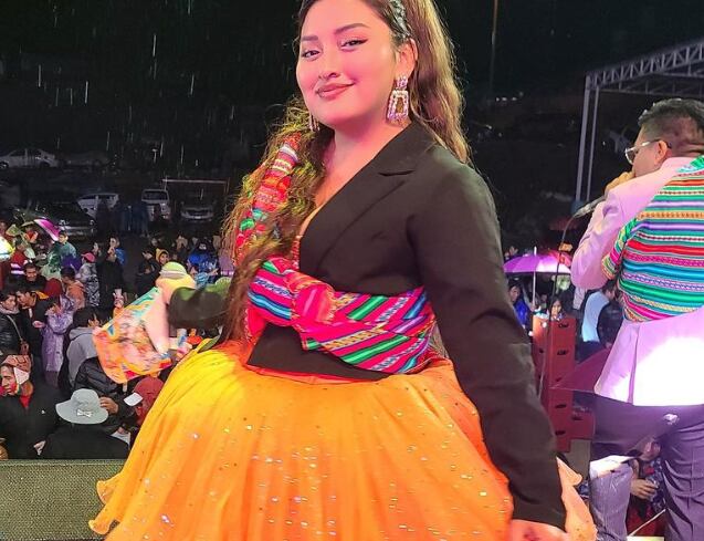 ‘Muñequita Milly’ murió a los 23 años tras realizarse una cirugía plástica.